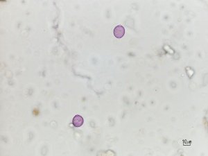 polline di brussonetia papyrifera al microscopio