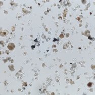 immagine anteprima per la notizia: analisi microscopiche delle polveri del sahara in friuli venez...