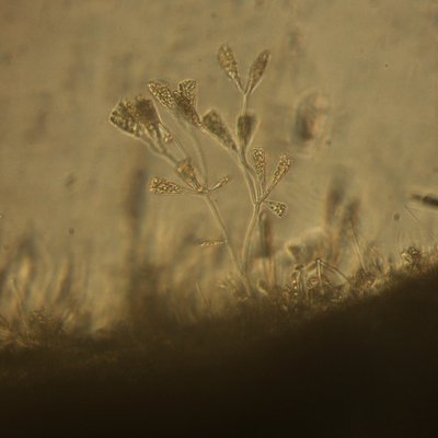 cellule di licmophora sp.p. che per mezzo di pedun...