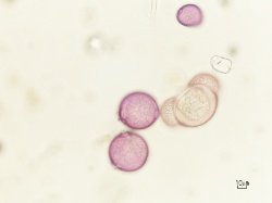 Polline di faggio al microscopio