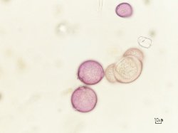 polline di faggio al microscopio