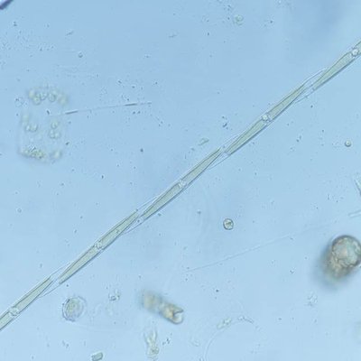 pseudo-nitzschia sp.p. - ing 32x - © arpa fvg