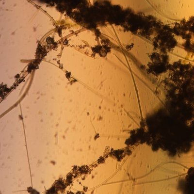 visione al microscopio ottico di aggregati di micr...