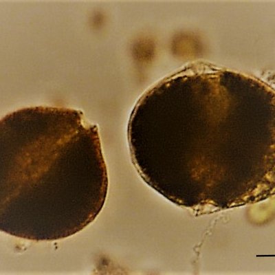 alexandrium cfr. taylorii, ingrandimento