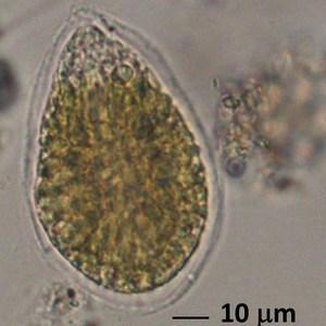 immagine anteprima per la notizia: ostreopsis ovata: un'alga da conoscere