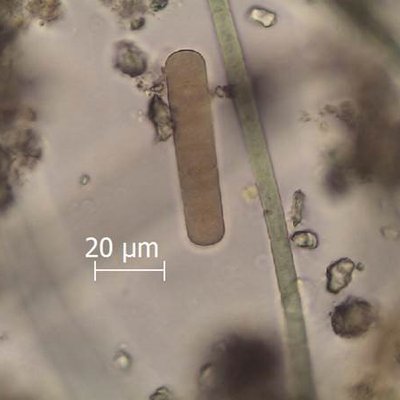 particolare di un filamento di cyanophyceae (foto ...