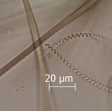 particolare di due diverse specie di cyanophyceae ...