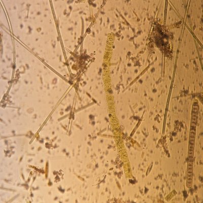 diatomee bentoniche e filamenti di cyanophyceae pr...