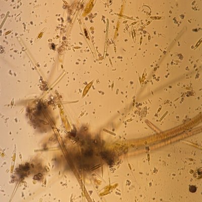 diatomee bentoniche frammenti di macroalghe e altr...