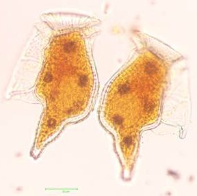 dinophysis caudata - ing. 40x - © arpa fvg