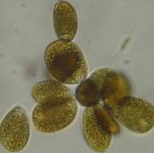immagine anteprima per la notizia: rientrata l'allerta per la fioritura di ostreopsis ovata a can...