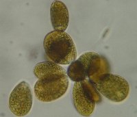 cellule di ostreopsis cfr. ovata al microscopio ot...