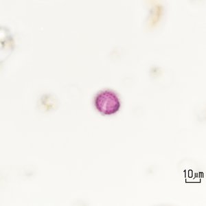 Iva-xanthifolia_polline.jpg
