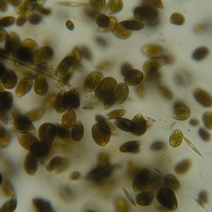 immagine anteprima per la pagina: ostreopsis ovata