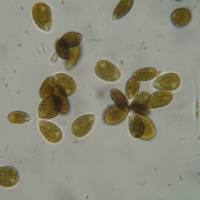 cellule della microalga ostreopsis cfr. ovata (mic...