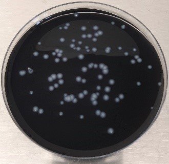 Capsula di Petri con colonie di Legionella pneumophila