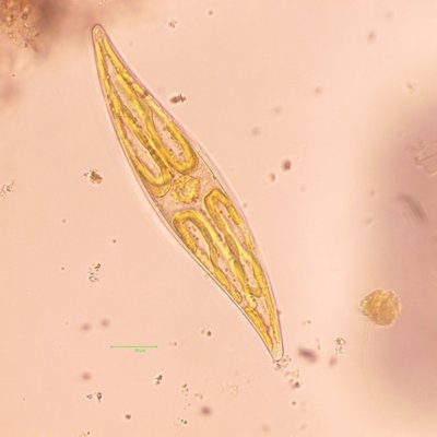 pleurosigma sp.p. - ing. 20x - © arpa fvg