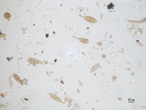 Alternaria al microscopio