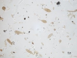 alternaria al microscopio