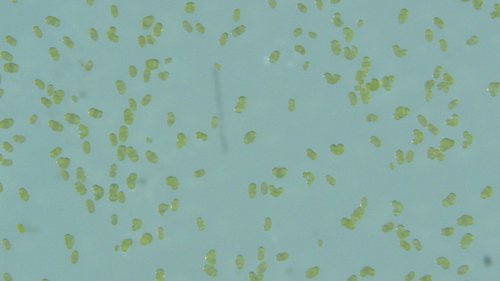 Figura 3. Immagine al microscopio dei granuli pollinici del pino marittimo.