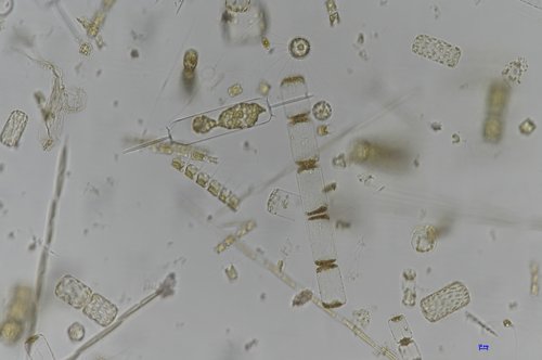 Organismi fitoplanctonici al microscopio ottico - Ing 20X - © Arpa FVG