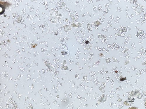 Immagine al microscopio ottico di particolato atmosferico campionato sulla nostra regione. Le particelle trasparenti sono di origine crostale o salina.