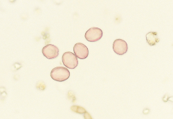 Pollini castagno al microscopio